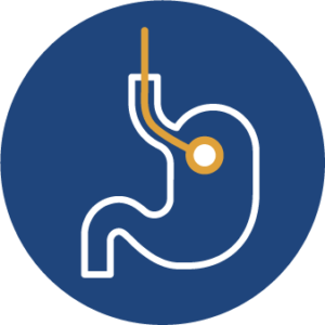 Icon für Magenspiegelung bei Dr. Remy Schwarzer